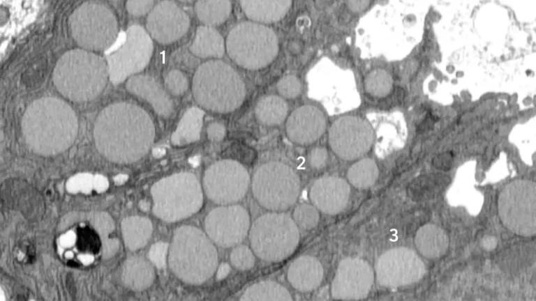 Cells “vomit” Waste In A Hidden Healing Shortcut That Could Also Fuel Cancer