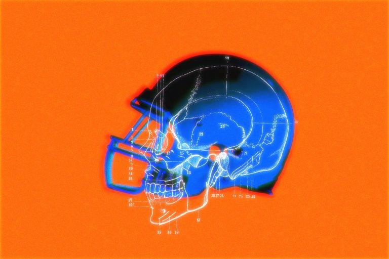 Why It’s So Hard To Make A ‘safer’ Football Helmet