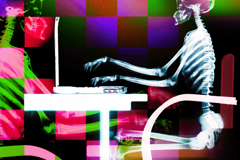 How To Prevent Tech Neck And Sit Properly With Your Laptop (2025)