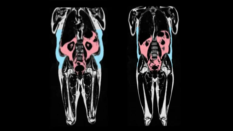 The Fat You Can’t See May Be Damaging Your Heart, Even If You Exercise